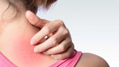 Dermatoloji Uzmanı Ünal: “Deri hastalıklarının çoğu güneşten kaynaklanıyor”