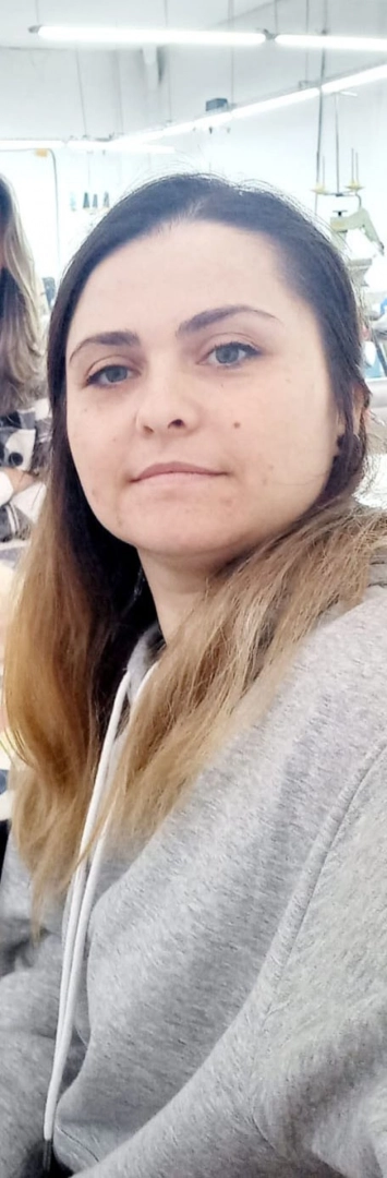 Güzelliğine mi güveniyorsun dedi, yüzüne kimyasal madde fırlattı