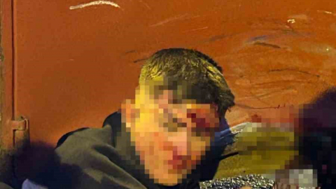 Kocaeli'de 2 motosiklet ve kamyonetin karıştığı kazada 4 kişi yaralandı