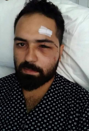 15 Temmuz Gazisi Koç: "Darbeci asker dalga geçer bir ses tonu ile ‘sen kelime-i şehadet getir’ dedi"