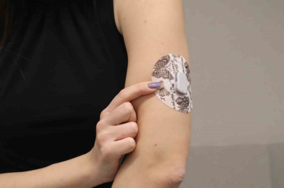 Diyabet tedavisinde yapay zeka destekli teknolojilerle "Yapay Pankreas" dönemi başlıyor