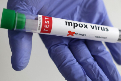 Maymun çiçeği virüsünün yeni bir türü tespit edildi