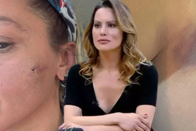 Ünlü oyuncu Yıldız Asyalı'dan şoke eden iddia: Kocam tarafından darp edildim!