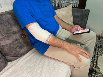 Başakşehir’de sitenin güvenlik görevlisine sahipli köpek saldırdı