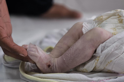 Gazze'de şiddetli soğuk nedeniyle bir aylık bebek hayatını kaybetti