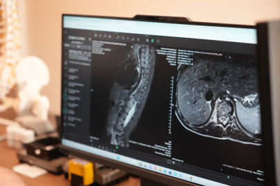 Sinsi ilerleyen bu rahatsızlığı ilk fark eden anneler oluyor