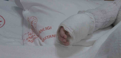 Üzerine kaynar su dökülen bebeğin vücudunun yüzde 27’si yandı