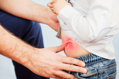 Uzmanından Uyarı: Kasık Fıtığında Erken Tanı ve Modern Tedavi Hayat Kurtarıyor