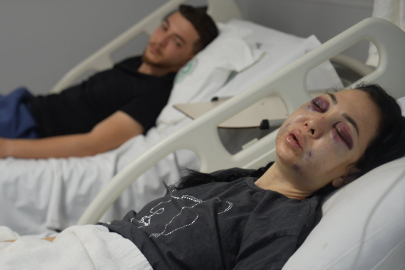 Oğlunun gözü önünde anneyi öldüresiye dövdüler: "'Küfür etmeyin' dedik diye bu hale geldim"