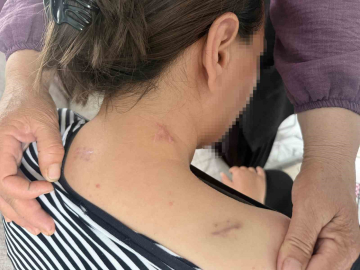 17 bıçak darbesi aldı, ölü numarasıyla kurtuldu, kocasının en ağır cezayı almasını istedi