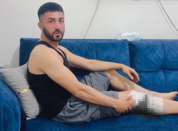 Nizip’te başıboş köpek saldırısında yaralanan 2 kişi belediyeye tepki gösterdi