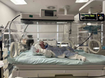 Mardin’de nadir görülen hastalıkla doğan bebek sağlığına kavuştu