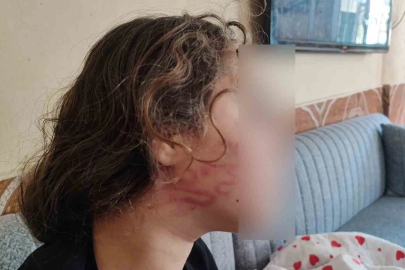 8 yaşındaki kızını darp eden çocuğun epilepsi hastası ablasını sokak ortasında dövdüğü iddiası
