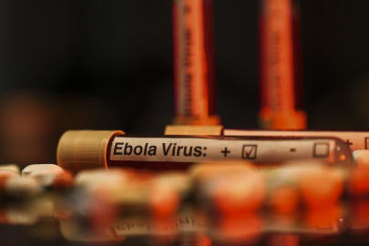 ABD'den Korkutan Ebola Uyarısı: Tarihin En Ölümcül Seviyesine Ulaşabilir
