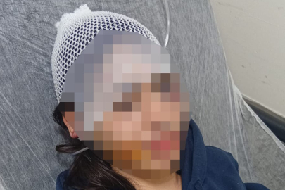 Ayrılık kararını kabullenemeyip kız arkadaşını darbeden sanık: "Çok üzgünüm"